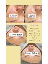 クレヴィー(Creviy)/毛穴洗浄＆ハーブ＆鼻のwax脱毛