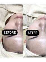 fallon beauty　痩身/フェイシャル/フェム・オムケア/アロマ/ボディケア/フェイシャル Wax脱毛