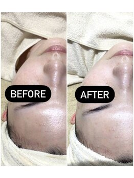 fallon beauty　痩身/フェイシャル/フェム・オムケア/アロマ/ボディケア/フェイシャル Wax脱毛