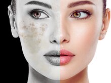 リボーン 柏(REBORN)/冬のエイジング対策