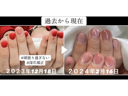 タビー(Tabby)の写真
