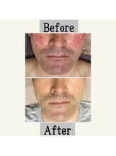 ペールノエル 富士宮店(PERENOEL)/フォトエステ(40代男性）