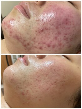 ホリホック/諦めるのはまだ早い！