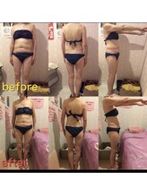 アンリール 旭川店(Anrire)/BODY施術のお客様です！