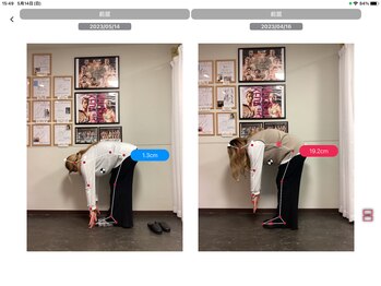 ナオル整体 浅草院(NAORU整体)/30代女性【腰痛・動作時痛】