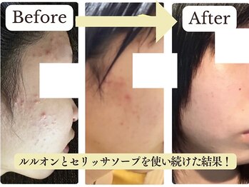 ヨサパーク アーバンヘブン 目黒(YOSA PARK Urban Heaven)/肌荒れ知らずの美肌が叶う!