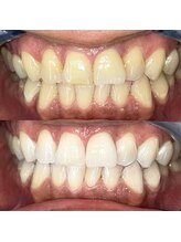 ライトビューティー 池袋店(LightBeauty)/症例写真