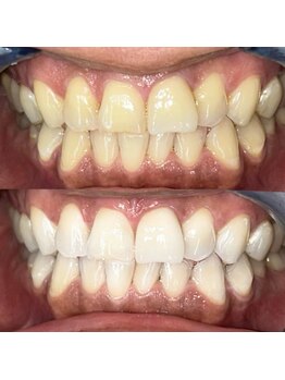 ライトビューティー 池袋店(LightBeauty)/症例写真