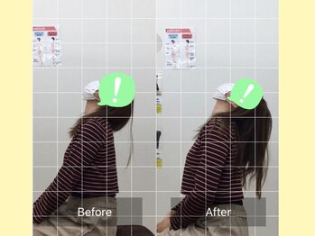 ナオル整体 大宮院(NAORU整体)/大宮/整体・猫背矯正・姿勢矯正