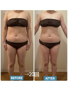 ヨサパーク レナータ(YOSA PARK Renata)/30代【痩身/小顔/美肌】20回