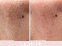 クラルテ(CLARTE)