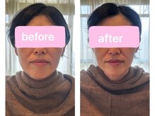 ツナギ 新座(TSUNAGI)/BeforeAfter