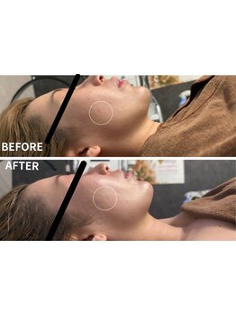 お肌をきれいにしたい