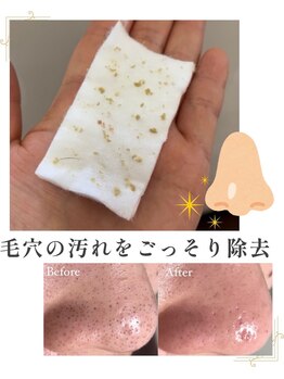 アルルプラス 山科(ARuru+)/毛穴エクストラクション