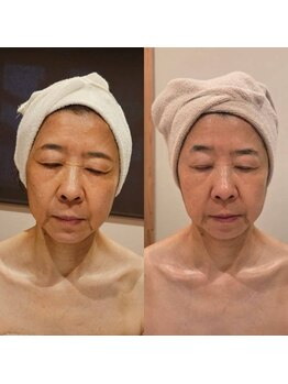 ルクス 富士宮店(Lux)の写真/あきらめていたシミしわに、未来のシミと今のしわを同時にケアする贅沢な時間を☆