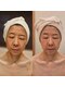 ルクス 富士宮店(Lux)の写真/あきらめていたシミしわに、未来のシミと今のしわを同時にケアする贅沢な時間を☆