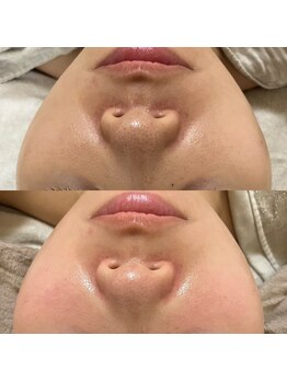 グラン ジュテ/毛穴ケア×LHALALA 泡洗浄