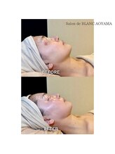 サロン ド ブラン アオヤマ(Salon de BLANC AOYAMA)/クリスティーナビオフィート