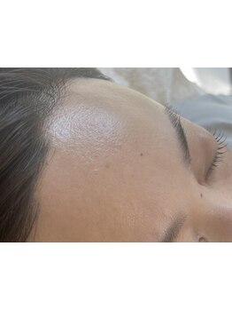 お肌をきれいにしたい