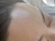 リル バイ ジャックインザボックス(rir by JACK-IN-THE-BOX)の写真/【マリムーブフェイシャルワックス正規認定サロン】美肌の土台作りにはフェイシャルワックス♪