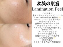 アトレ アンド ミューズ(Attrait×Muse)の雰囲気（LaminationPeelのbefore/after【無加工写真】本格肌育）