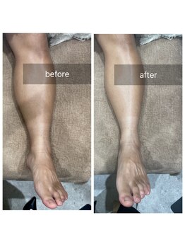 ガレリア エステ 名駅(GALLARIA)/炭酸リフレクソロジー