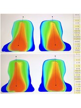 ビオプラス 広尾本店(bioplus)/3ヶ月の変化