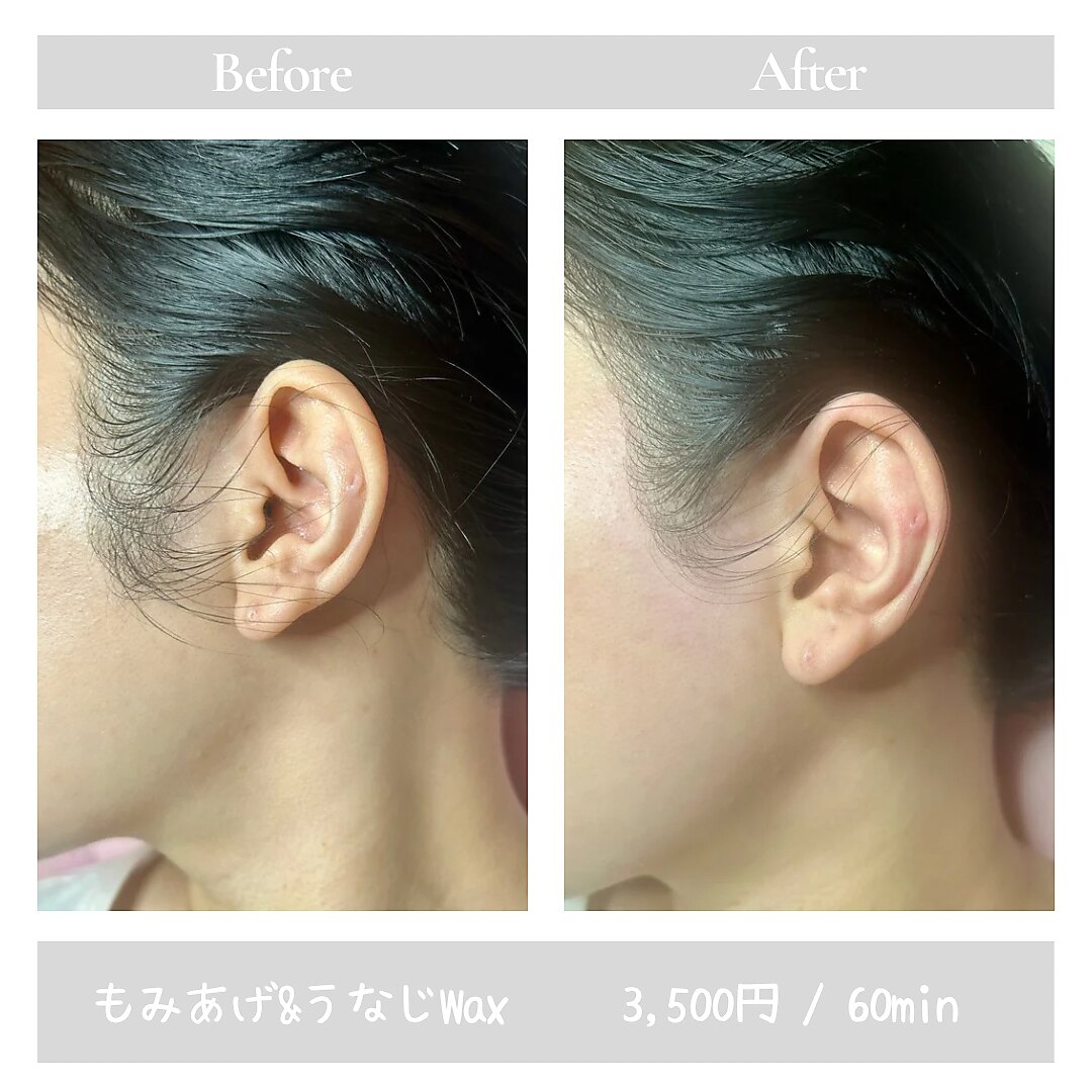 ブラジリアンワキシング シックスナイン(BrazilianWaxing69