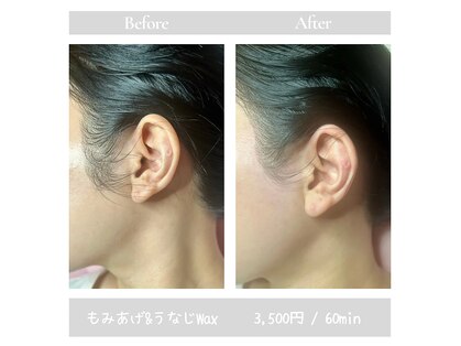 ブラジリアンワキシング シックスナイン(BrazilianWaxing69)の写真