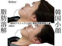 リベルキョウト 京都駅前店(Liber Kyoto)/レモンボトル超え!二重顎撃退