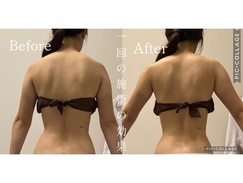 ラムール(L'amour)/痩身リンパマッサージで結果出し
