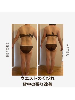 エイミー 藤ヶ丘店(Amy)/before→after