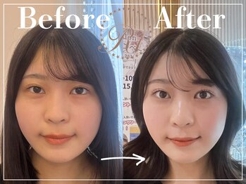 R-1ビューティーサロン 表参道/Before&After