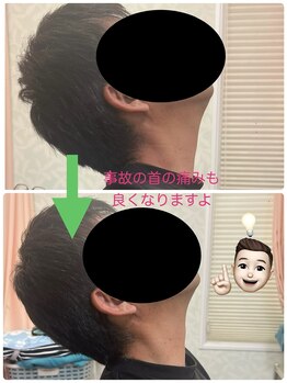 しもえのお整骨院/首の痛みが楽になります。