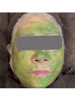 ここはなの写真/お肌のトラブルにお悩みの方には『ハーブピーリングコース』がオススメ☆肌質を底上げしてウルツヤ肌に♪