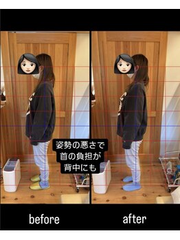 はまもと整骨院/整体・姿勢改善
