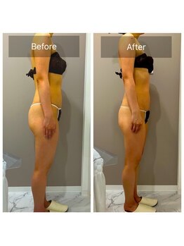 オーバイワン 横浜店/お客様Before&After【3】