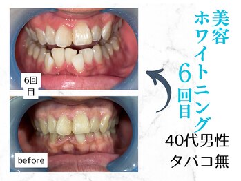 ルカノン(le canon)/長年の口臭悩みから解放ー◎