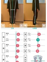 リックス整体/姿勢計測で体の歪みが分かります