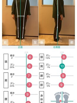 リックス整体/姿勢計測で体の歪みが分かります