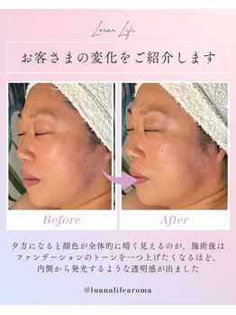ルアナライフ(Luana Life)/ヒアルロン酸とアミノ酸を導入！