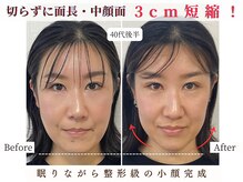 エソア(esoa)の雰囲気（オペや糸リフト、注入いらず！痛みなく骨格から引き上げ小顔に）