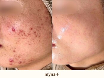 マイナプラ 表参道(myna+)/