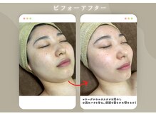 用宗整骨院/ビフォーアフター