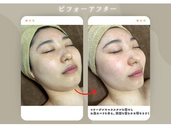 用宗整骨院/ビフォーアフター