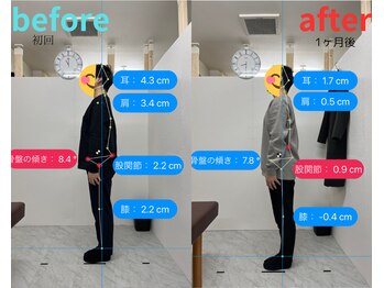 トワニ整体 新富町院(TOWANI整体)/猫背/銀座/新富町/築地/整体