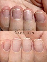 マリーロール 淀屋橋本店(Marie Laure)/自爪育成/深爪矯正/ネイルケア