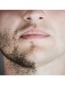 【メンズ脱毛 】痛みの少ないヒゲ脱毛で、毎朝の煩わしさ、肌荒れも改善◎