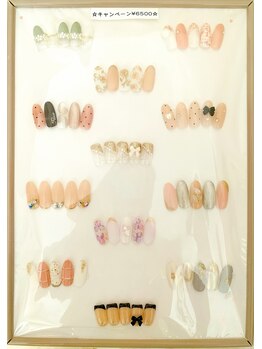 ビューティーハウスエンジェル/当店定額ネイル¥6500