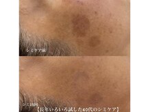 サロンビューティー美優の雰囲気（長年のシミメラニン老け肌10歳つや肌の変化を実感◎牛込神楽坂）